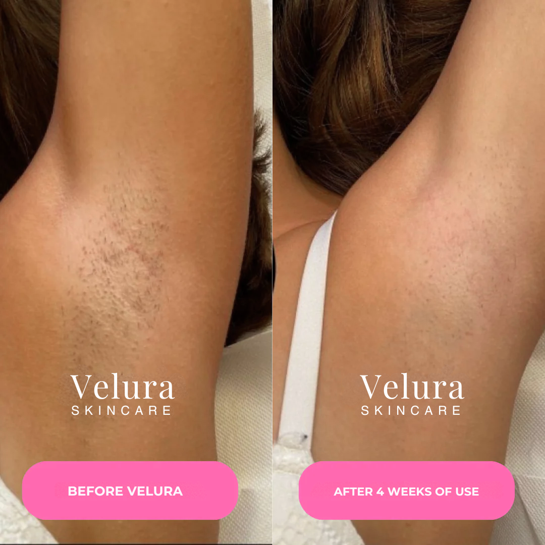 Velura® Cyperus Rotundus Serum