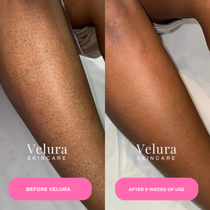 Velura® Cyperus Rotundus Serum