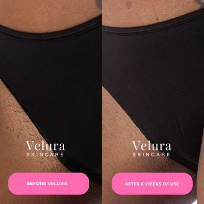 Velura® Cyperus Rotundus Serum
